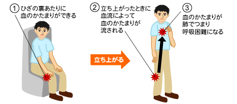 【地震情報】被災者は「低体温症」「エコノミー症候群」などに注意